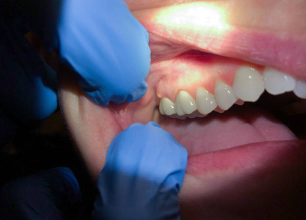 Best Emergency Root Canal Treatment in Nahunta, GA